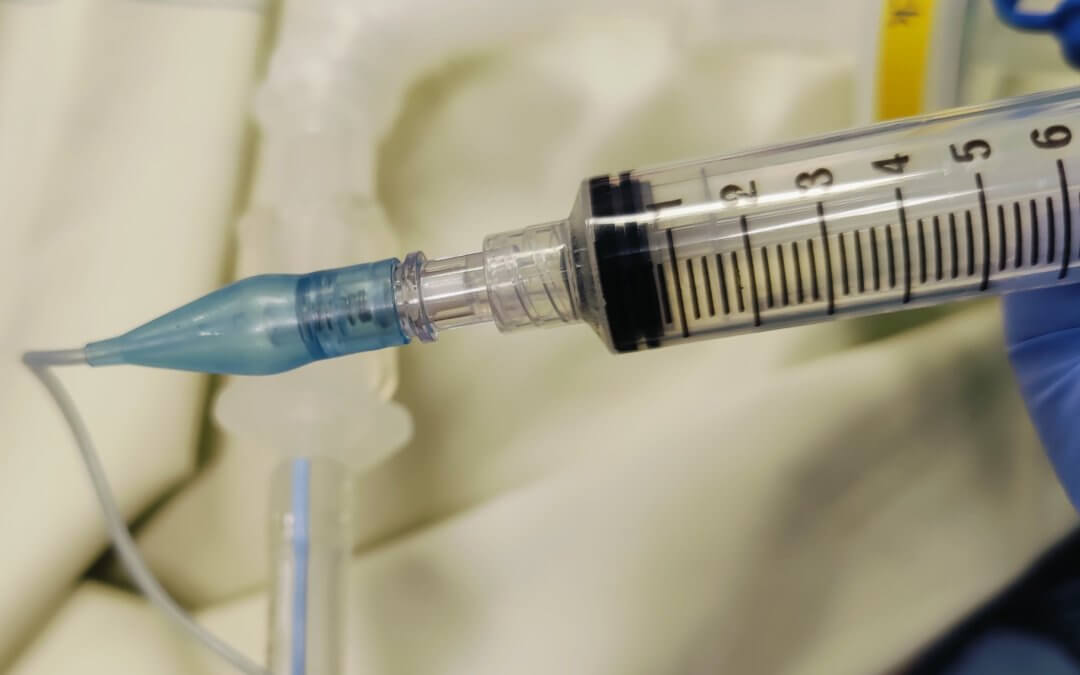 Extubation par l&rsquo;Infirmier.e Diplômé.e d&rsquo;Etat